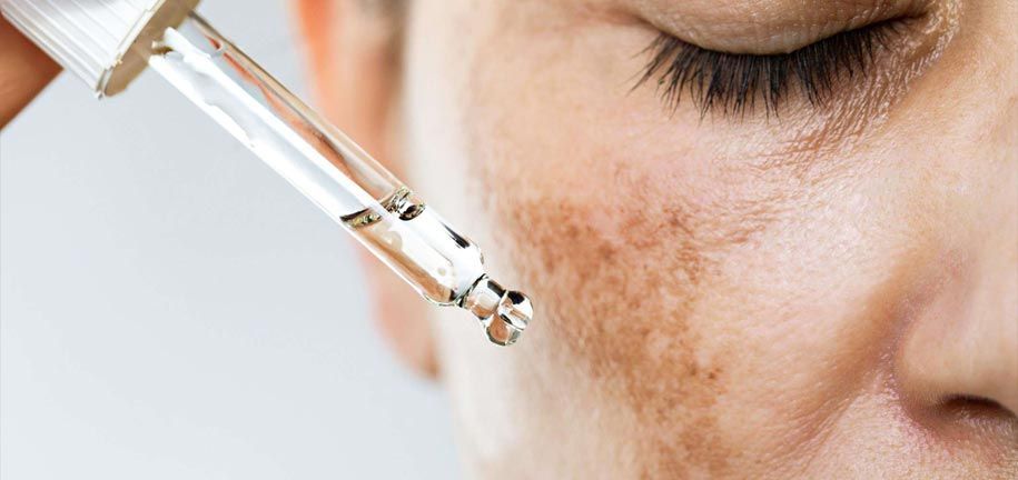 Formas efectivas de tratar la hiperpigmentación