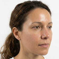 Cuidado de la piel para piel mixta
