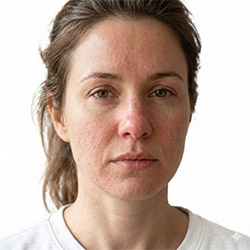 Cuidado para sequedad e irritación