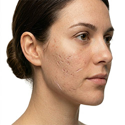 Productos de cuidado de la piel para cicatrices visibles y textura irregular en rostro y cuerpo